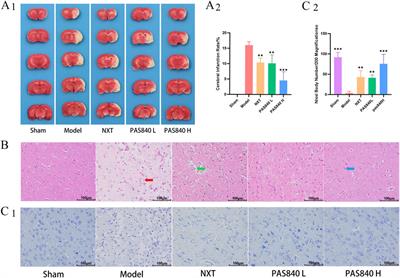 Investigation of the effects of Periplaneta americana (L.) extract on ischemic stroke based on combined multi-omics of gut microbiota